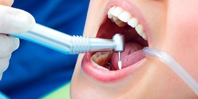 endodoncia