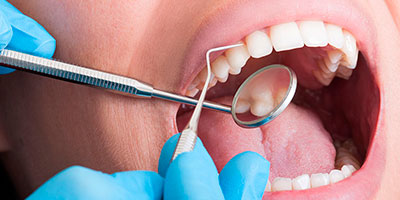 periodoncia