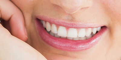 sonrisa